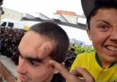 Skateboarder Sprouts Huge Bump After Fall