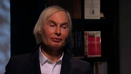 Cutera Excel V  Brandt