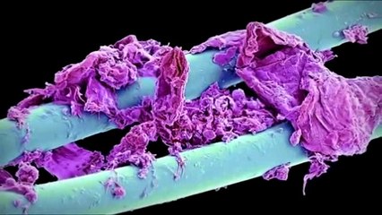 Normal things will shock you under the microscope