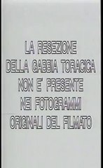 UFO Dossier X - 05 - Autopsie di alieni (parte 1)