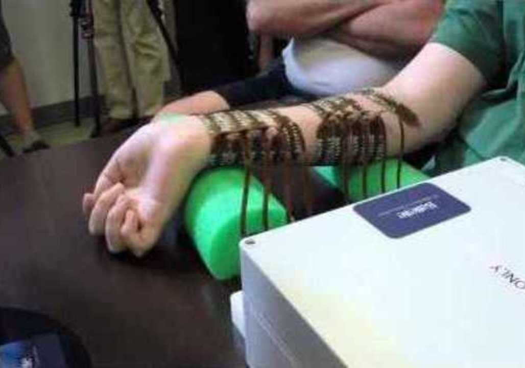 Paralyzed Man Moves His Hand Using His Own Thoughts