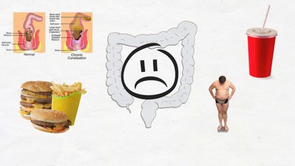How To Relieve Constipation: HealthyNow QuickTip Episode 1
