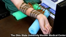 Paralyzed Man Moves Hand For First Time In 4 Years