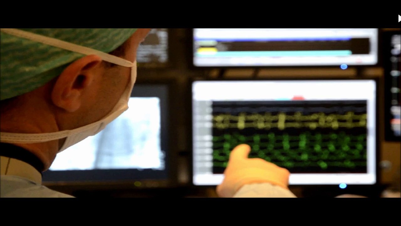 Ablation ou médicaments dans la FIBRILLATION ATRIALE. Dr.Jérôme Horvilleur