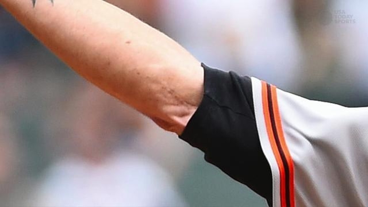 Tommy John elbow surgery procedure