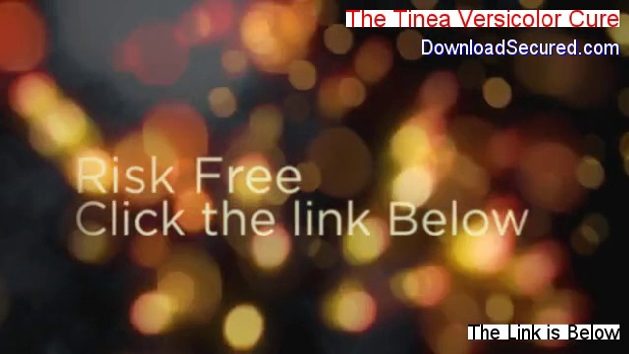 The Tinea Versicolor Cure Reviews - Video Review 2014