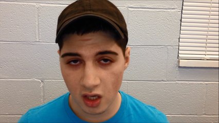 Saline injections are good for Acne Scars