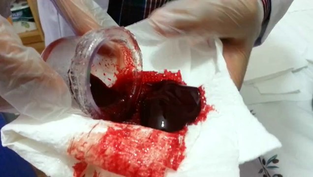 VAN HACAMAT VE SÜLÜK TEDAVİ MERKEZİ