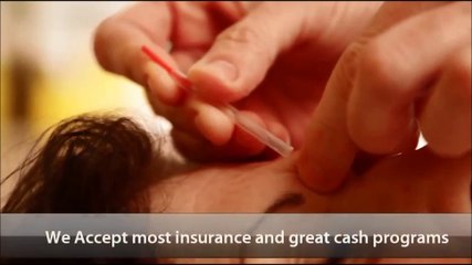 Shoulder pain, Bennett Acupuncture, Fountain Valley