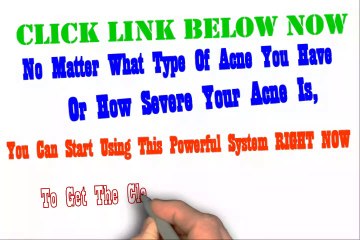 How To Get Rid of Acne Scars on Back PERMANENTLY