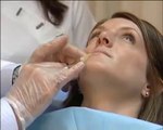 Facial Fillers Treatment
