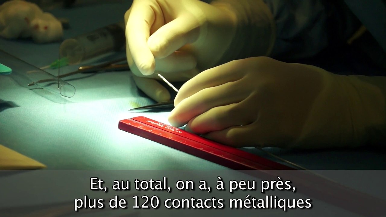 Epilepsie, sclérose en plaques : l'OCIRP soutient l'ICM