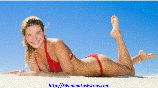 como curar las estrias