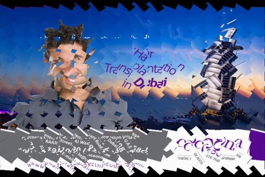 FUE Hair Transplant Clinic Dubai