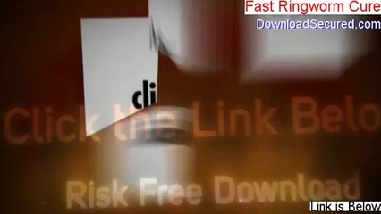 Fast Ringworm Cure Free Download - Download Now