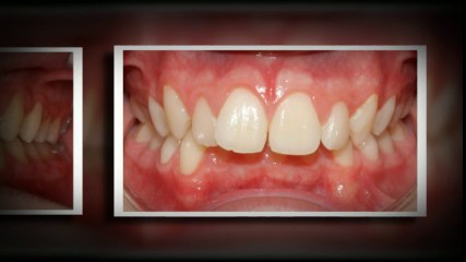 Dallas Orthodontists June2014