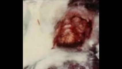 Le retour du mystérieux Homme des Glaces du Minnesota