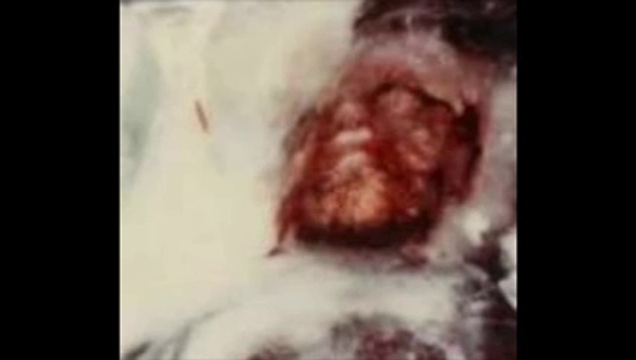 Le retour du mystérieux Homme des Glaces du Minnesota