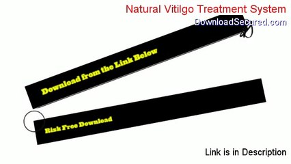 Natural Vitilgo Treatment System PDF (Legit Download 2014)