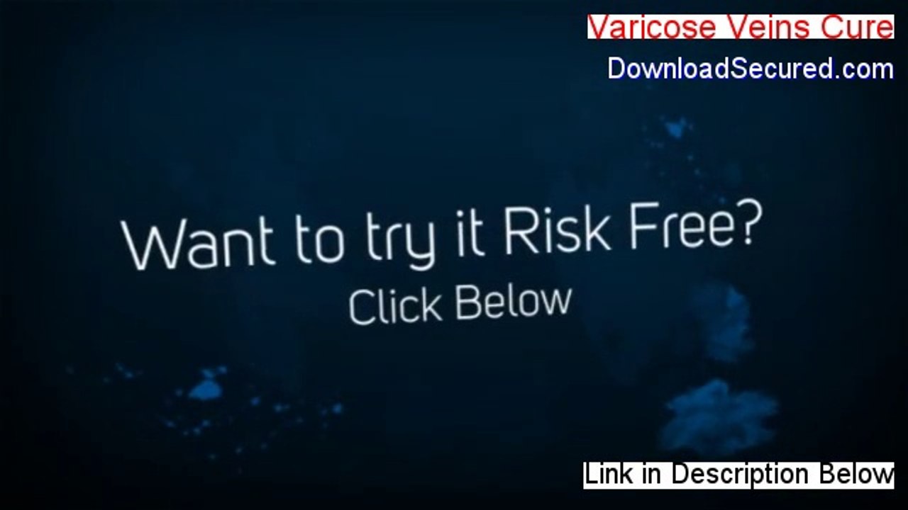 Varicose Veins Cure Download Free - Legit Download [2014]