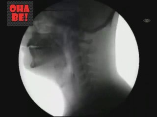 Yemek yerken X-RAY de nasıl gözüküyorsunuz.. OhaBe.Tv