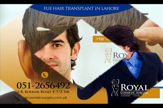 FUE Hair Transplant in Pakistan | FUE Hair Transplant in Islamabad | FUE Hair Transplant in Lahore