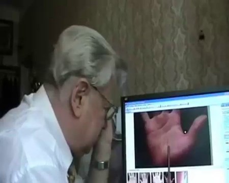 Как проводится удаленная видео консультация по фото рук. Видео анонс