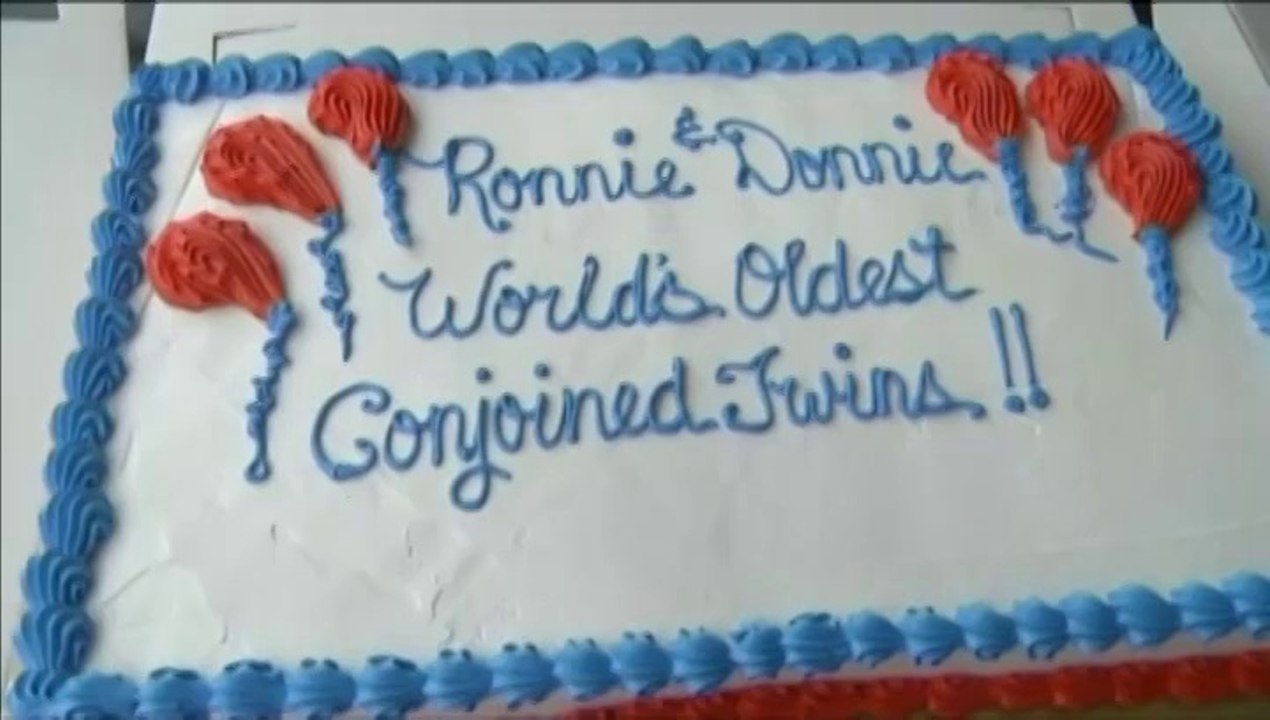 A 62 ans, deux frères siamois battent un record de longévité