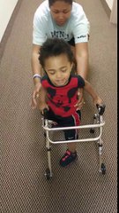 Amputee Toddler Learning To Walk Will Inspire You