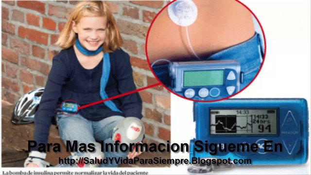 Las Bombas De Insulina Mejoran El Control Del Azucar En Diabetes Tipo 2
