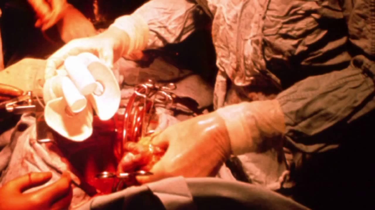 Cardiologists | Cardiovascular Disease | Cardiovascular Problems | Healthy Heart | Heart Defects | Heart Disease Specialist | Heart Specialist | Heart Valvular Disease