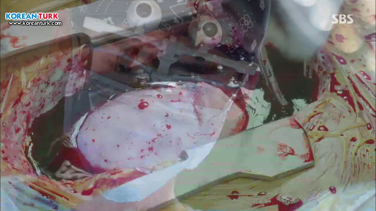 er.E20.END.1O_clip0