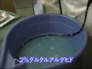 強酸性水で内視鏡（胃カメラ）の消毒～劇薬よりも安全に強力に