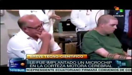 Gracias a un chip, enfermo parapléjico movió un brazo con su mente