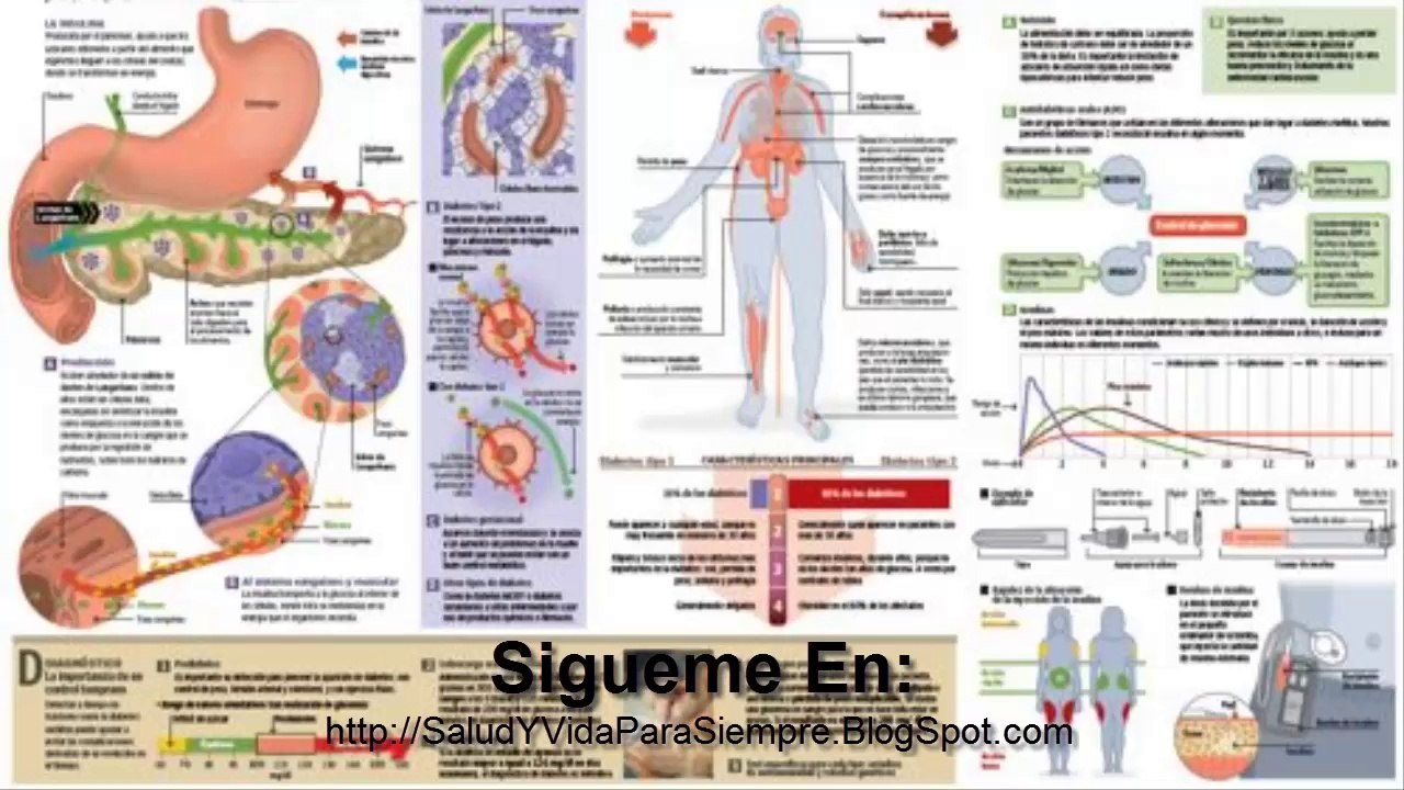Pie Diabetico Se Detectan En 150 Pacientes