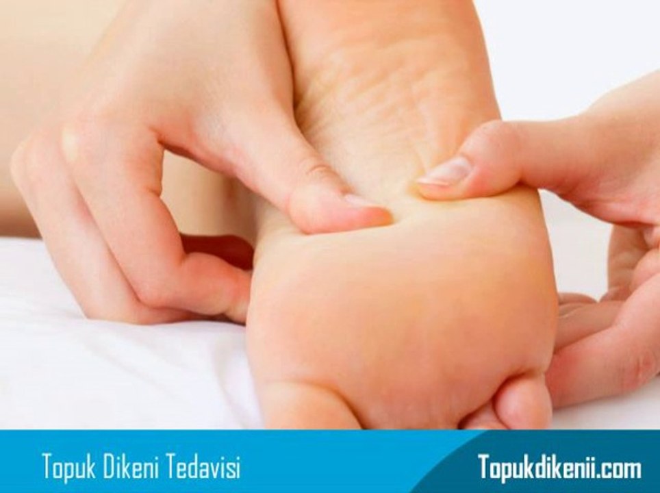 Topuk Dikeni Tedavisi Kayseri