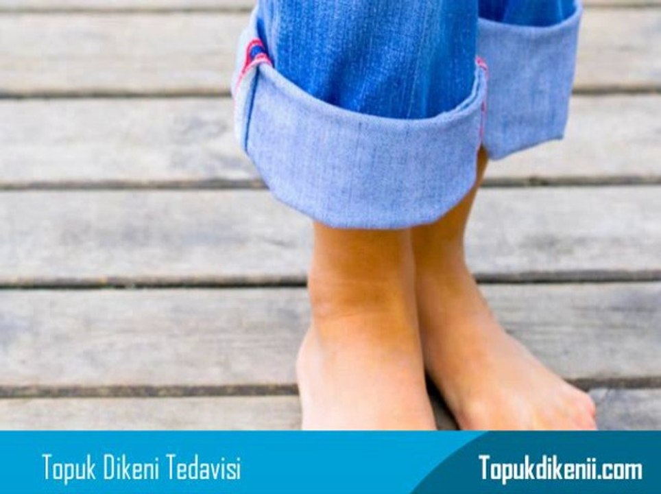 Topuk Dikeni Bitkisel Tedavi