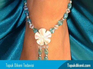 Topuk Dikeni Tedavisinde Kullanılan İlaçlar