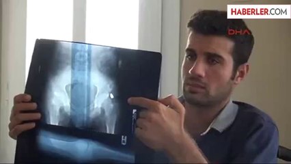 Ahmed'i Felç Eden Polise 7 Bin 500 Lira Para Cezası