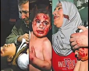 গাজার ইসরাইলি অমানবিক বর্বরতার গণহত্যা কিছু চিএ