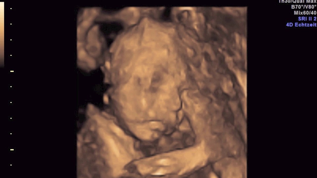 Lorenz 3D Clip (SSW25+2)