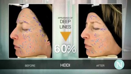 Heidi's Nerium AD Review