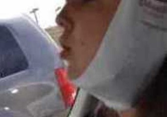 Jessica Mumbles After Wisdom Tooth Anaesthetic