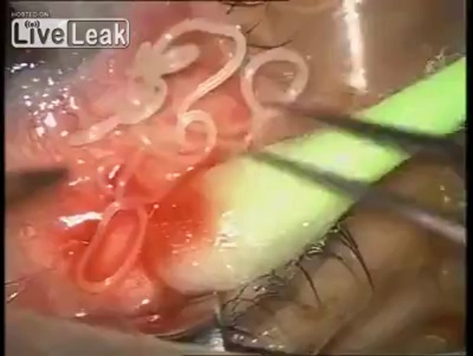 O QUE TIRAM DE UM OLHO DESTA PESSOA