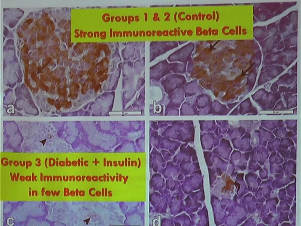 ICHN-2014 Clinical and Therapeutic Nutrition An extract from date seeds stimulus endogenous insulin secretion in type 1 Diabetic Rats Prof. Dr. Ahmed El Fouhil-cut