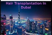 Hair Transplant Cost in Dubai