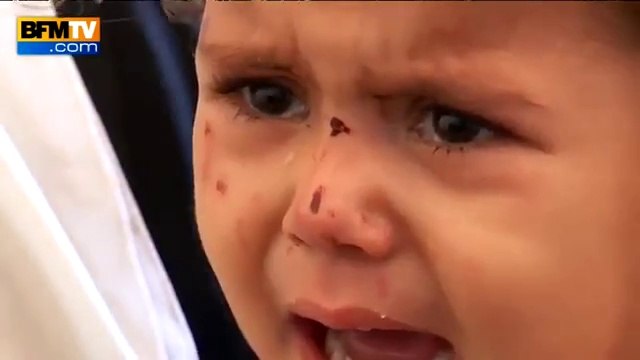 REPORTAGE - A Gaza, des Palestiniens victimes de bombardements à l'hôpital - 18/07