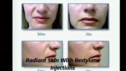 Dr. Monte O. Harris of Center for Aesthetic Modernism offers a Variety of Restylane