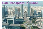 Hair Transplant Cost in Dubai