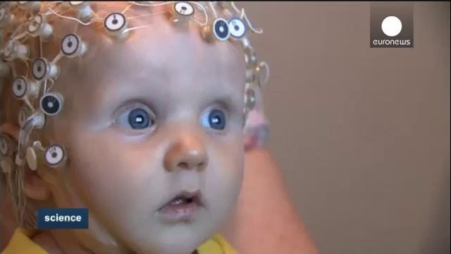 Cerebro autista: Diagnostico precoz (Percepcion de caras)